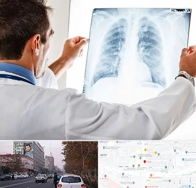 دکتر متخصص ریه در کارگر شمالی 