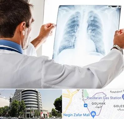 دکتر متخصص ریه در قلهک 