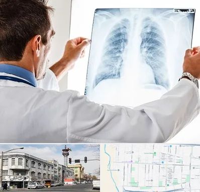 دکتر متخصص ریه در 17شهریور