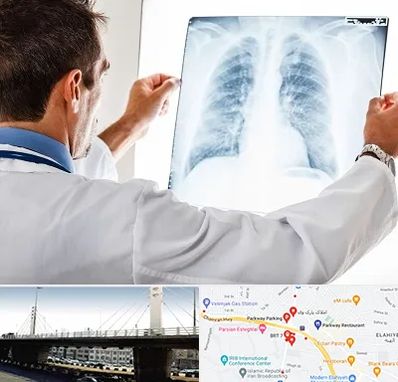 دکتر متخصص ریه در پارک وی 