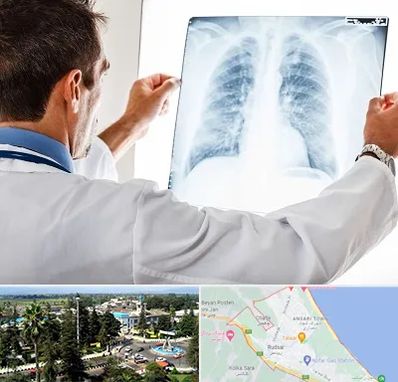 دکتر متخصص ریه در رودسر