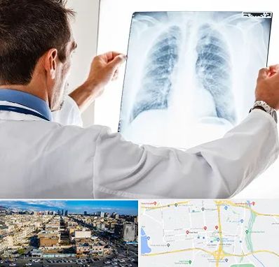 دکتر متخصص ریه در شهرک راه آهن