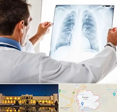 دکتر متخصص ریه در برازجان