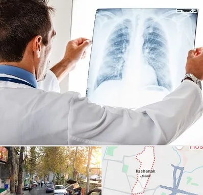 دکتر متخصص ریه در کاشانک