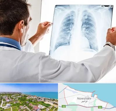 دکتر متخصص ریه در نوشهر