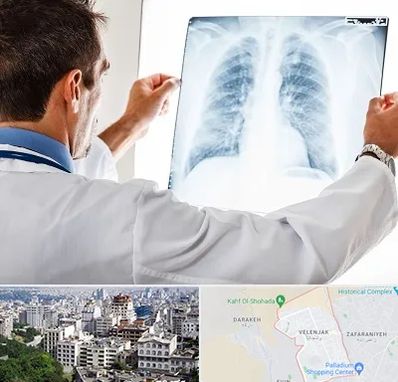 دکتر متخصص ریه در ولنجک 