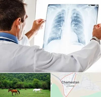 دکتر متخصص ریه در چمستان