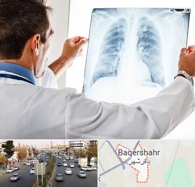 دکتر متخصص ریه در باقرشهر
