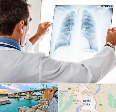 دکتر متخصص ریه در دزفول