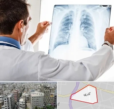 دکتر متخصص ریه در آذری
