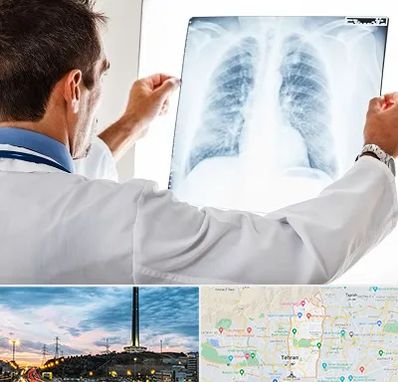 دکتر متخصص ریه در منطقه 2 تهران 