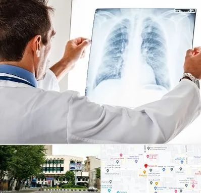 دکتر متخصص ریه در طالقانی 