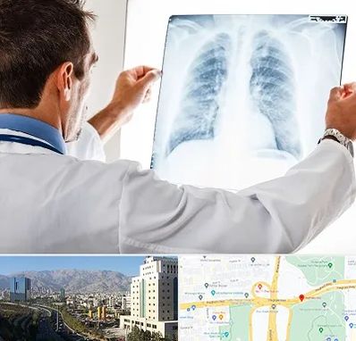 دکتر متخصص ریه در حقانی 