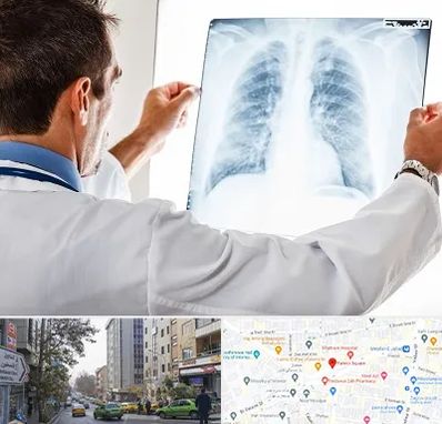 دکتر متخصص ریه در فاطمی 