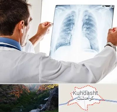 دکتر متخصص ریه در کوهدشت