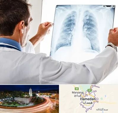 دکتر متخصص ریه در همدان