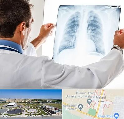 دکتر متخصص ریه در ملارد