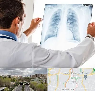 دکتر متخصص ریه در یوسف آباد 