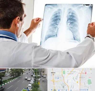 دکتر متخصص ریه در ستارخان 