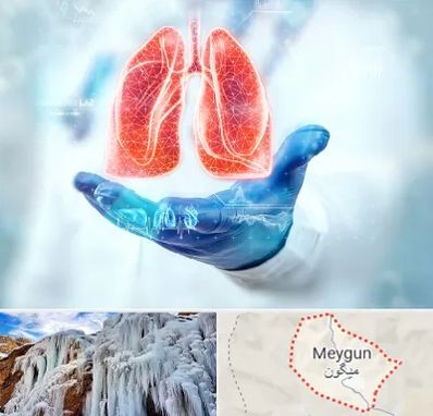 بیمارستان ریه در میگون