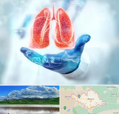 بیمارستان ریه در مرند