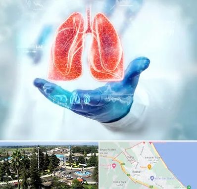 بیمارستان ریه در رودسر