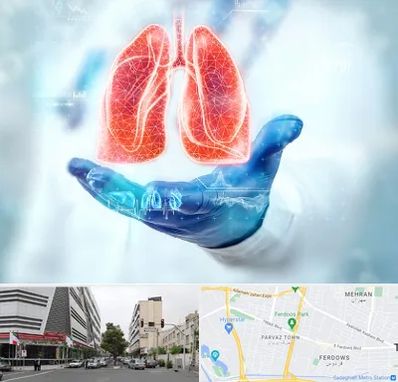 بیمارستان ریه در بلوار فردوس 