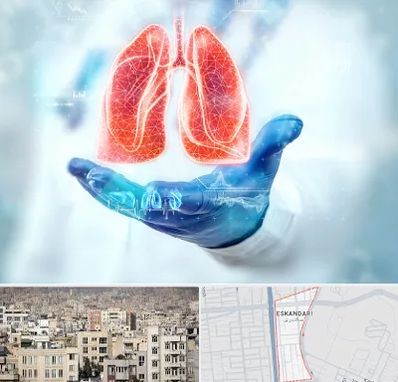 بیمارستان ریه در اسکندری