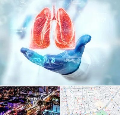 بیمارستان ریه در منظریه رشت