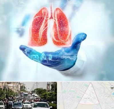 بیمارستان ریه در سیدی مشهد