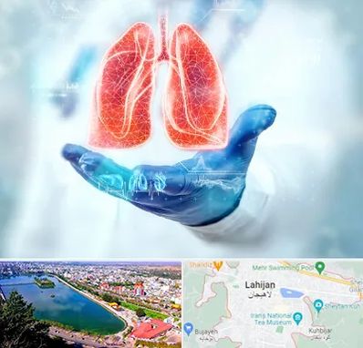 بیمارستان ریه در لاهیجان