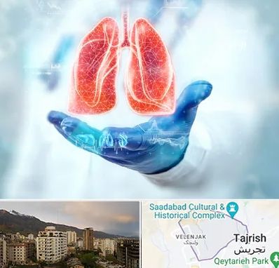 بیمارستان ریه در زعفرانیه 