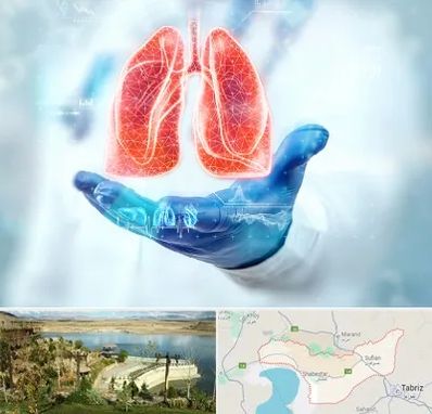 بیمارستان ریه در شبستر
