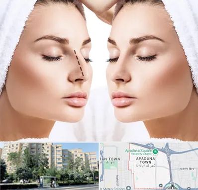 عمل بینی در آپادانا