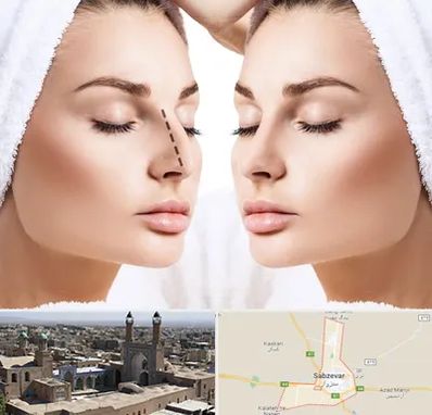 عمل بینی در سبزوار