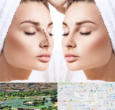 عمل بینی در منطقه 9 تهران