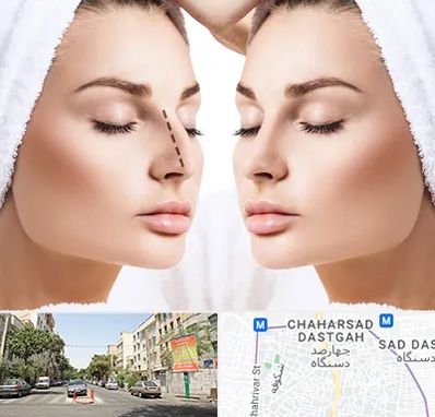 عمل بینی در چهارصد دستگاه