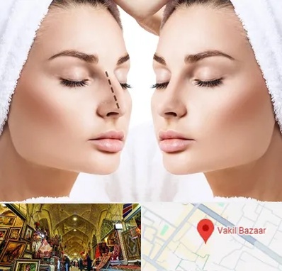 عمل بینی در بازار وکیل شیراز