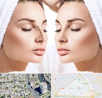 عمل بینی در قاسم آباد مشهد