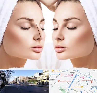 عمل بینی در خیابان ملاصدرا شیراز