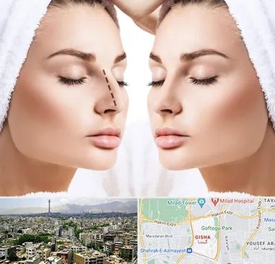 عمل بینی در گیشا