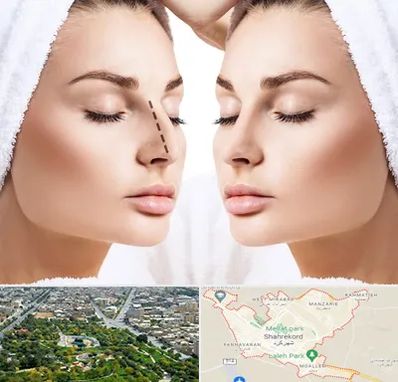 عمل بینی در شهرکرد