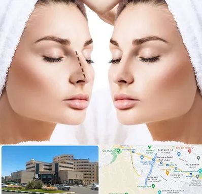 عمل بینی در صیاد شیرازی مشهد