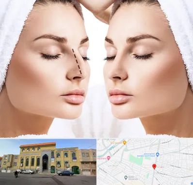 عمل بینی در زنبیل آباد قم