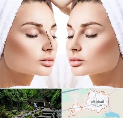 عمل بینی در علی آباد کتول