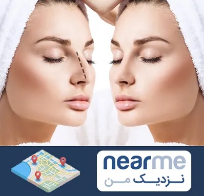 عمل بینی در نزدیک من