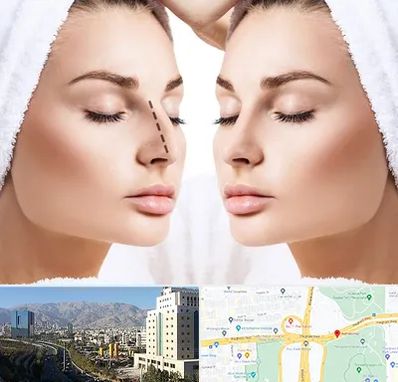 عمل بینی در حقانی