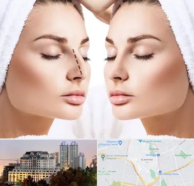 عمل بینی در فرشته