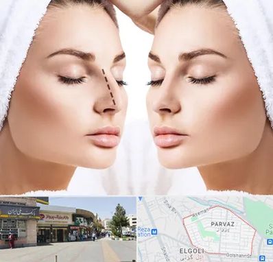 عمل بینی در پرواز تبریز