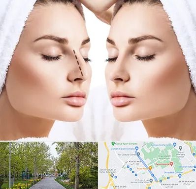 عمل بینی در قدوسی غربی شیراز